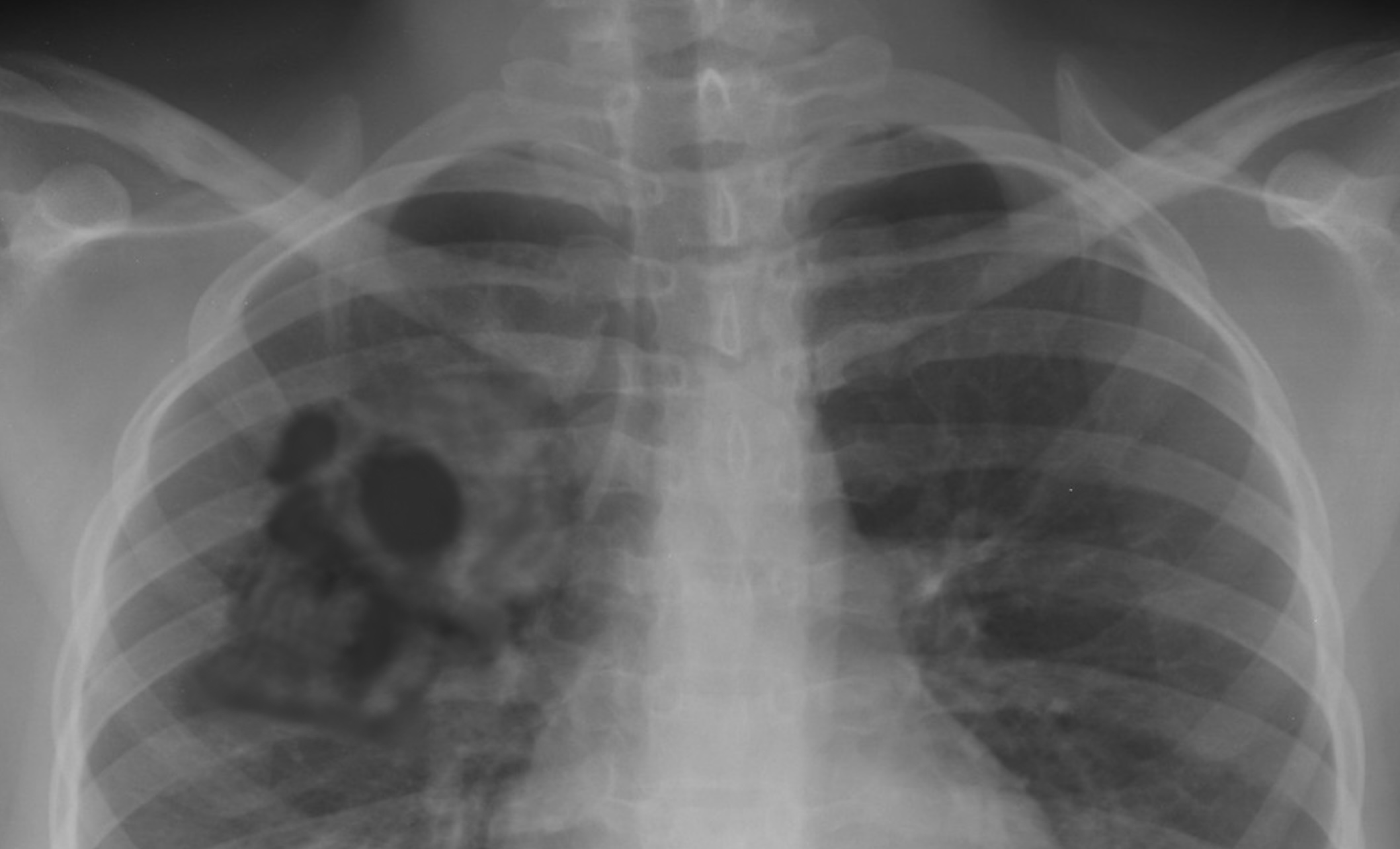 %E8%83%B8%E3%81%AE%E9%AA%A8