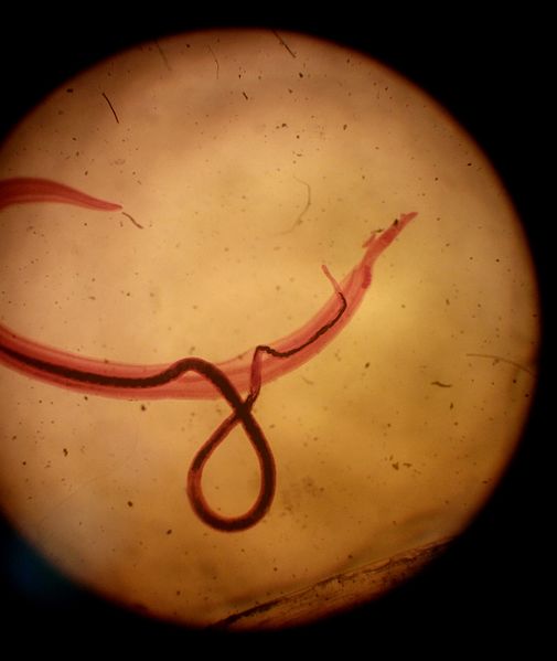 Spirometra-tapeworm-image-new.jpg