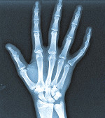 hand-1.jpg