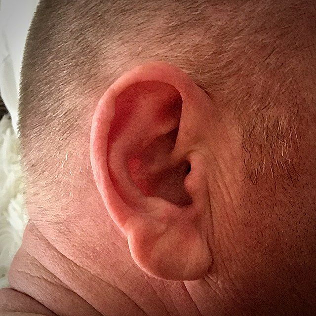 ear1.jpg