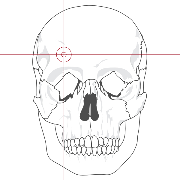 human_skull_fatal_point.jpg